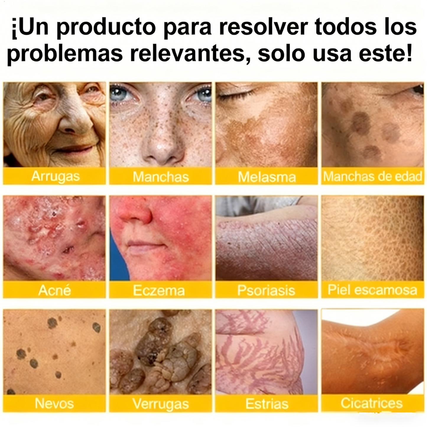 Alivio para huesos y articulaciones con veneno de abeja — 🔥70 % de descuento por tiempo limitado🔥