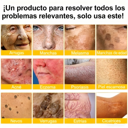 Alivio para huesos y articulaciones con veneno de abeja — 🔥70 % de descuento por tiempo limitado🔥