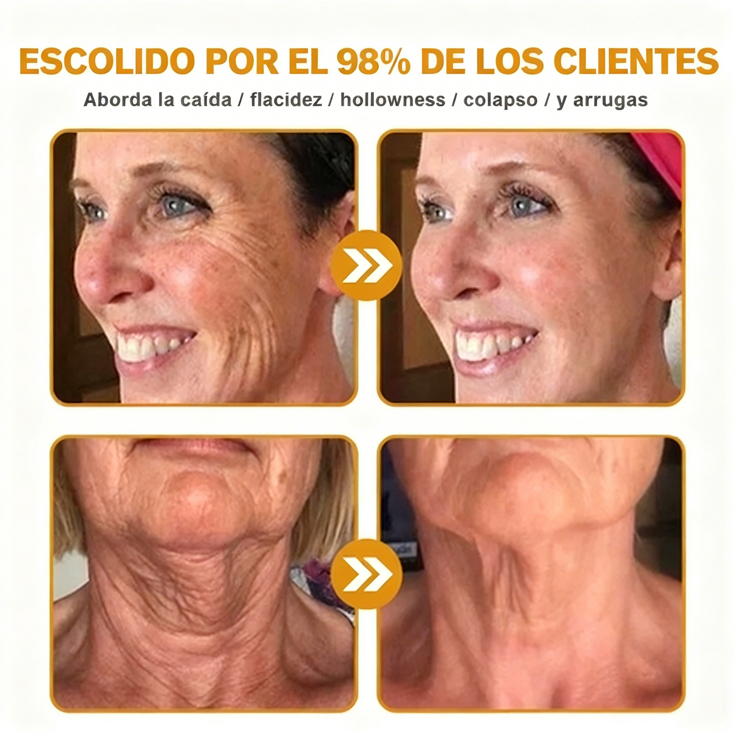 Crema restauradora de la piel con veneno de abeja Cleansing® aprobada por la FDA — 🔥70 % de descuento por tiempo limitado🔥