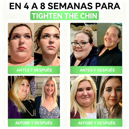 La solución oral para el peso y la salud Solaryra® GLP-1 + SGLT-2i favorece la pérdida de peso, mantiene la salud cardiovascular, mejora la diabetes, aborda la apnea del sueño, promueve la salud intestinal, reafirma la piel y proporciona energía.-XA