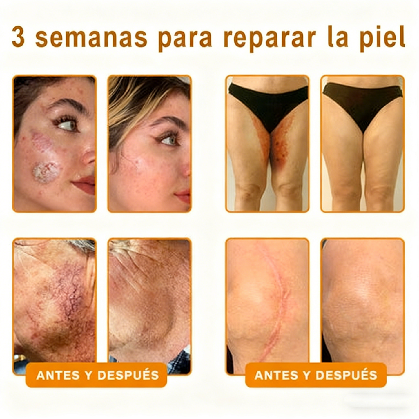 Alivio para huesos y articulaciones con veneno de abeja — 🔥70 % de descuento por tiempo limitado🔥