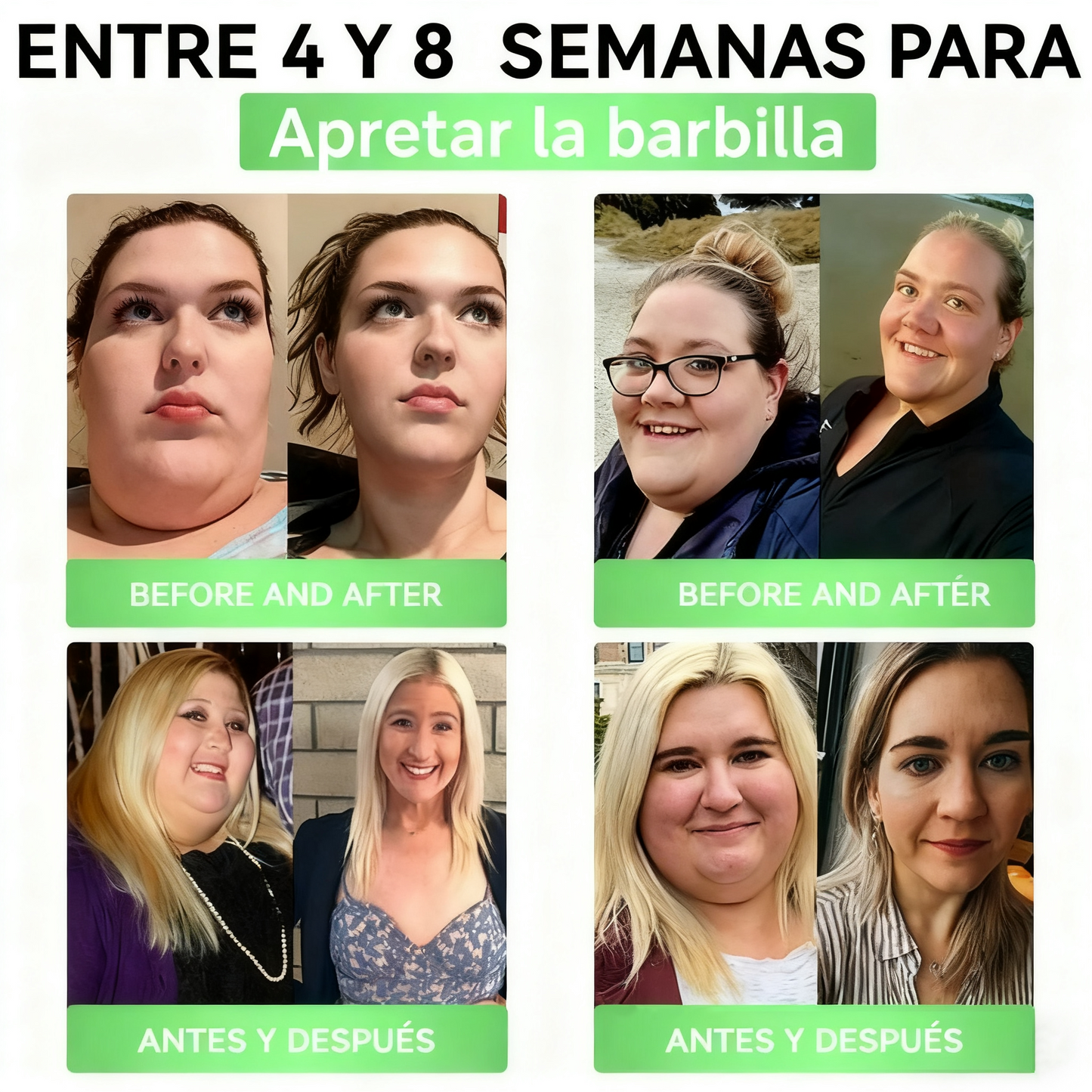 Solaryra® GLP-1 20 en 1 Suplemento Adelgazante (Resultados Visibles en 7 Días) ayuda a mejorar la obesidad, la salud cardiovascular, la diabetes, la salud intestinal, los problemas articulares, una piel más firme y un aumento de energía.-XA
