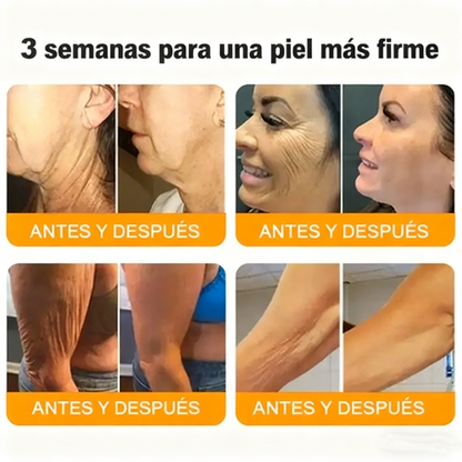 Crema restauradora de la piel con veneno de abeja Cleansing® aprobada por la FDA — 🔥70 % de descuento por tiempo limitado🔥