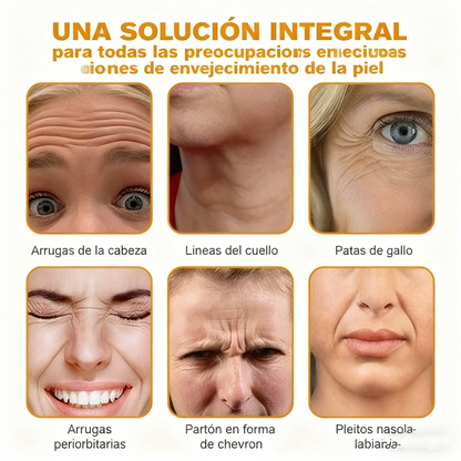 Crema Solaryra® para eliminar arrugas con veneno de abeja y botox (fabricada y enviada desde EE. UU.)