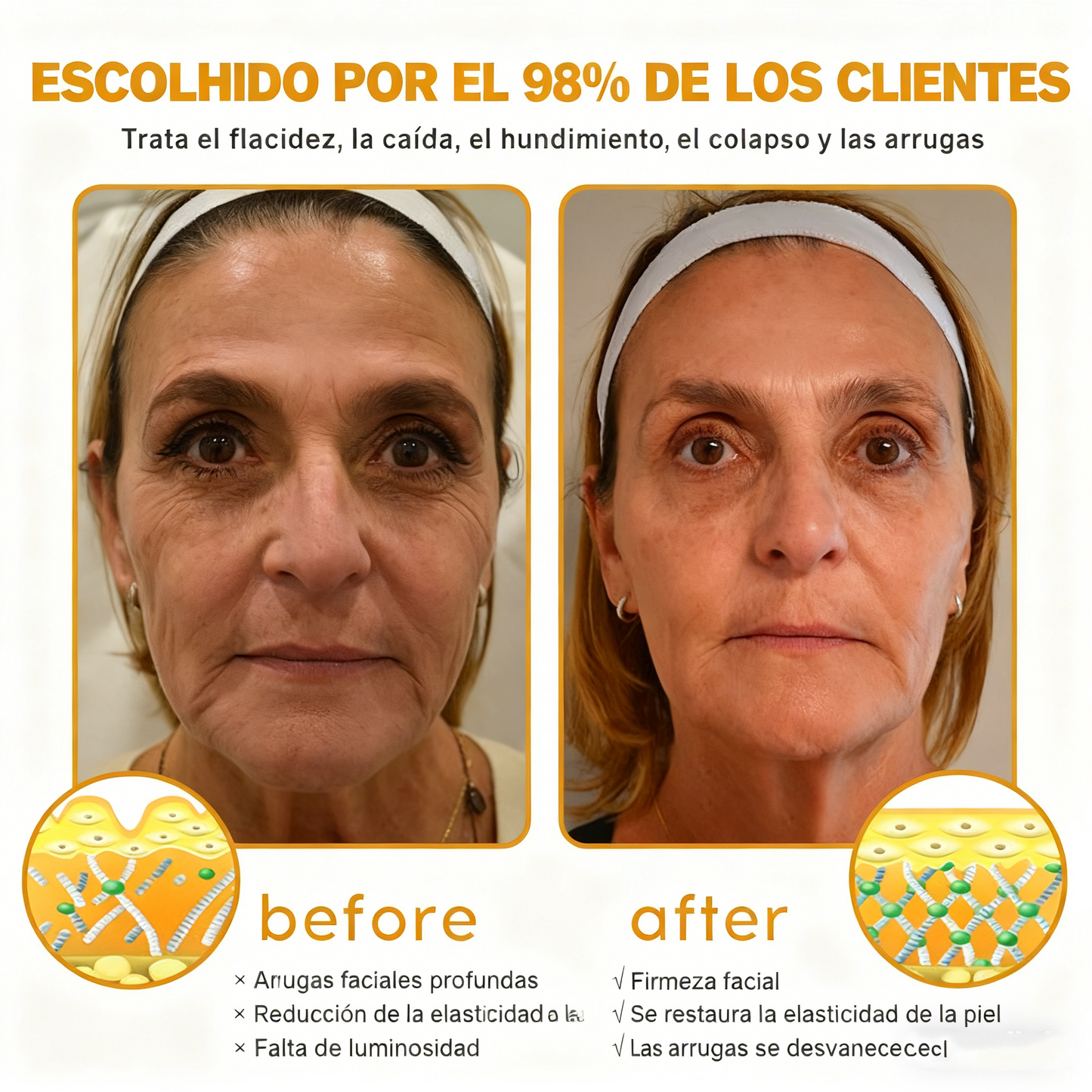 Crema Solaryra® para eliminar arrugas con veneno de abeja y botox (fabricada y enviada desde EE. UU.)