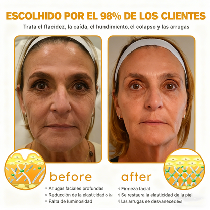 Crema Solaryra® para eliminar arrugas con veneno de abeja y botox (fabricada y enviada desde EE. UU.)