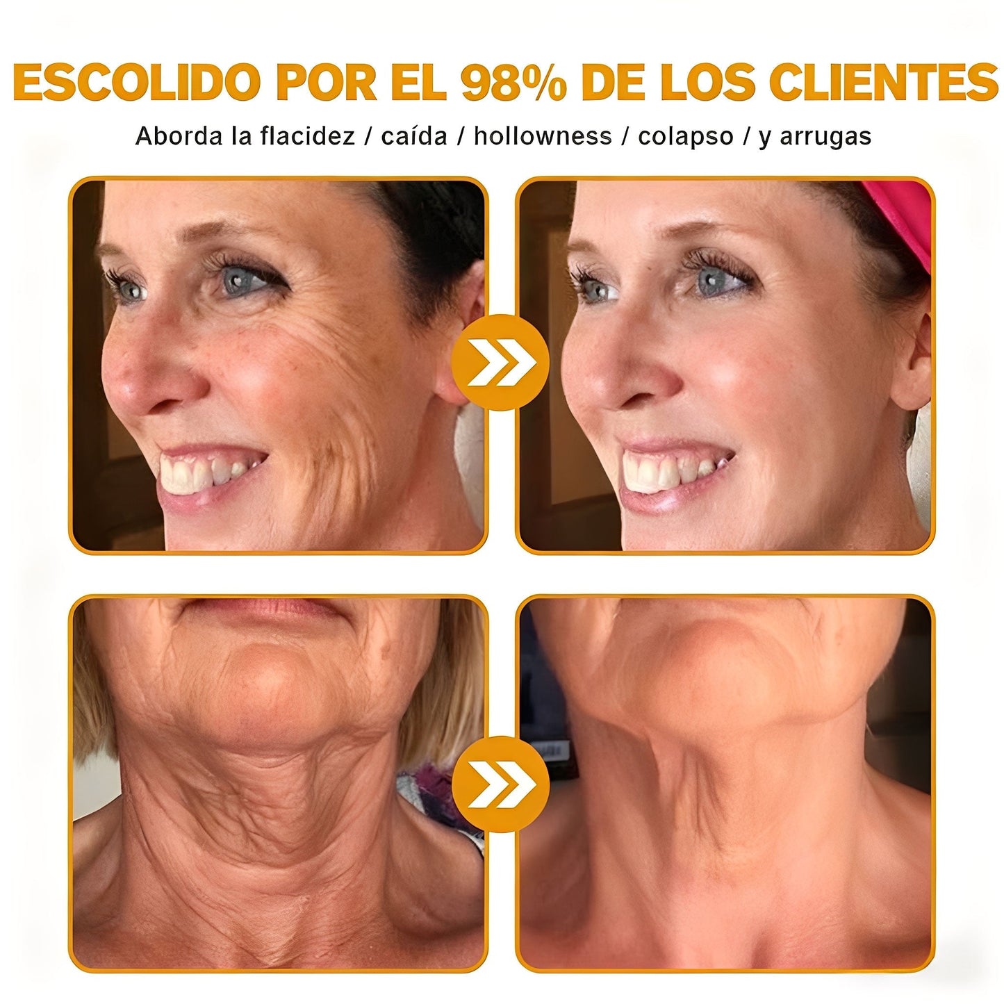 Crema Solaryra® para eliminar arrugas con veneno de abeja y botox (fabricada y enviada desde EE. UU.)